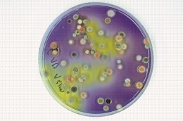 Ascospores de Sclerotinia sclerotiorum en culture : la germination acidifie le milieu